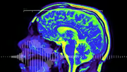 Of sound mind: Music video made in MRI scanner